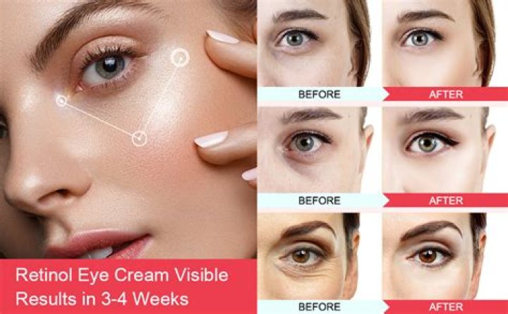 Under eye brightening cream - How To Discuss